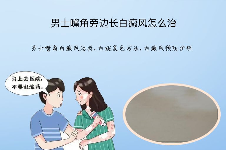 男士嘴角旁边长白癜风怎么治”