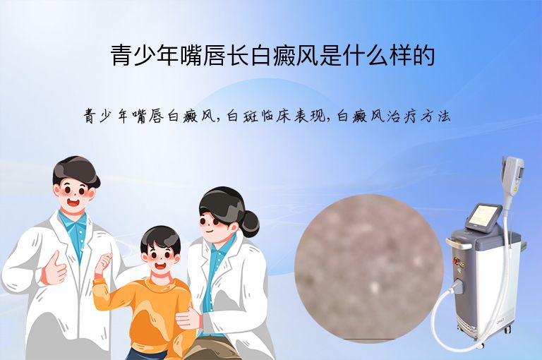 青少年嘴唇长白癜风是什么样的”