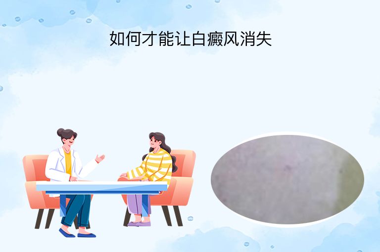 如何才能让白癜风消失”