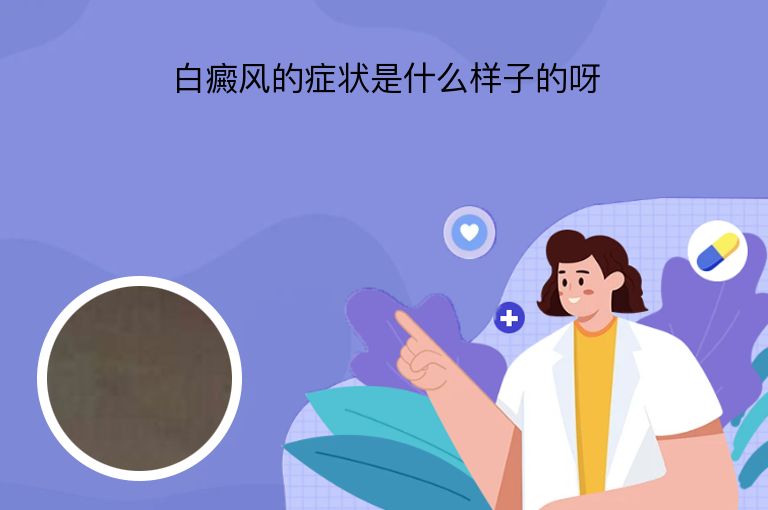 白癜风的症状是什么样子的呀