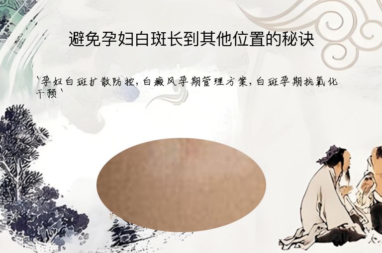 避免孕妇白斑长到其他位置的秘诀