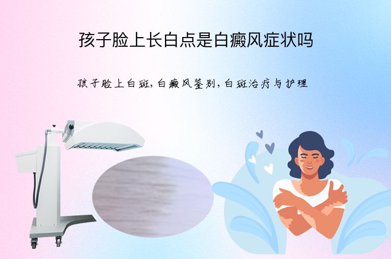 孩子脸上长白点是白癜风症状吗”