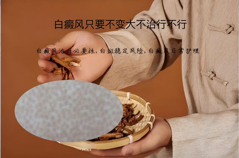 白癜风只要不变大不治行不行”