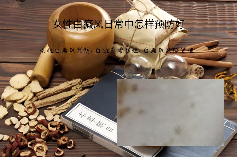 https://www.bdfsjzyy.com/d/file/p/4914a41050eba97b626f4ea199ed269b.jpeg