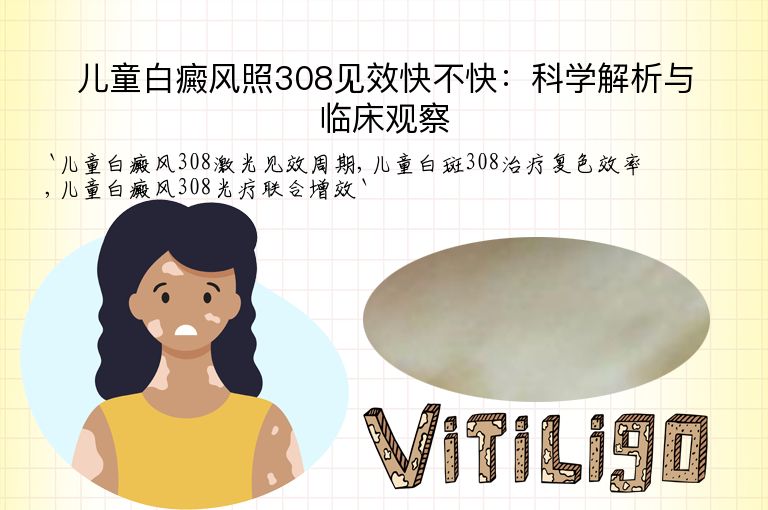 儿童白癜风照308见效快不快:科学解析与临床观察