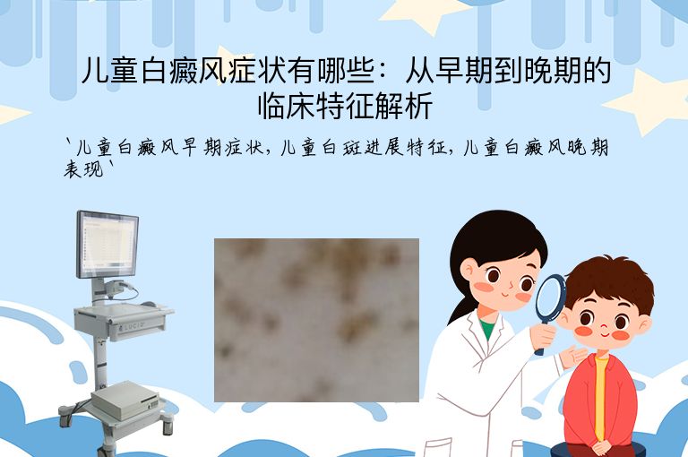 儿童白癜风症状有哪些:从早期到晚期的临床特征解析