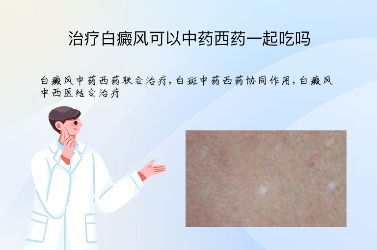 治疗白癜风可以中药西药一起吃吗”