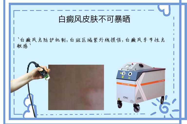白癜风皮肤不可暴晒