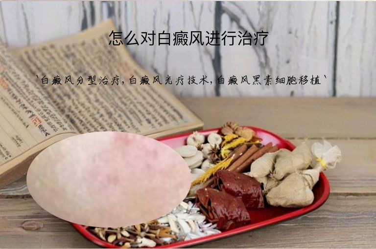 怎么对白癜风进行治疗”