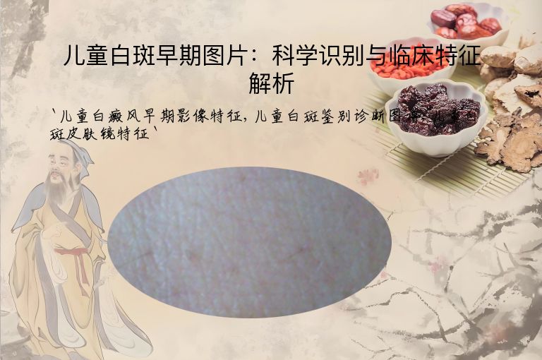 儿童白斑早期图片:科学识别与临床特征解析