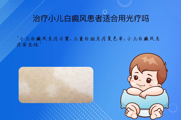 治疗小儿白癜风患者适合用光疗吗
