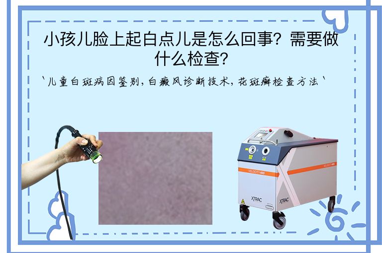小孩儿脸上起白点儿是怎么回事?需要做什么检查?