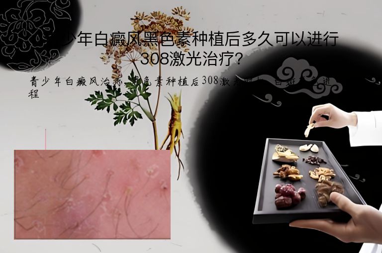 https://www.bdfsjzyy.com/d/file/p/e2dc99fd278aa1071c094de52ea8af57.jpeg