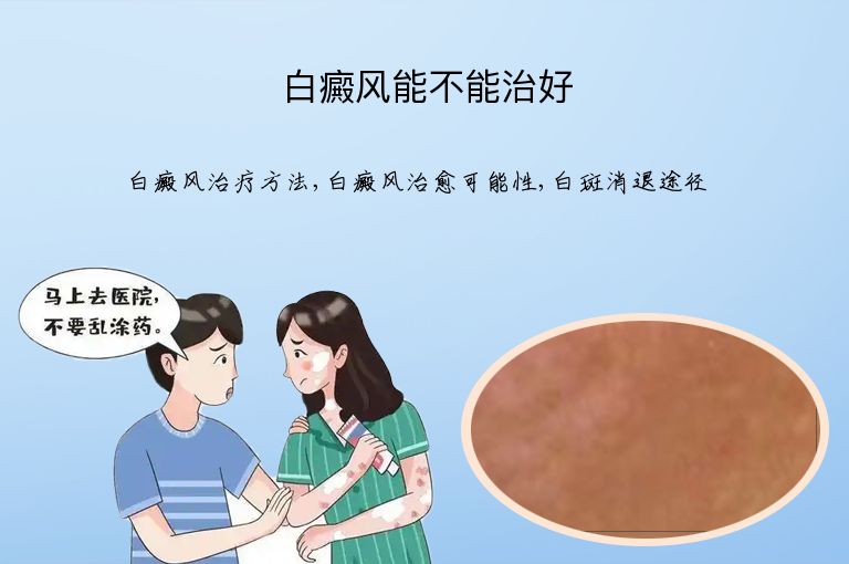 https://www.bdfsjzyy.com/d/file/p/9fce36a4db750777bbbce19470da29ed.jpeg