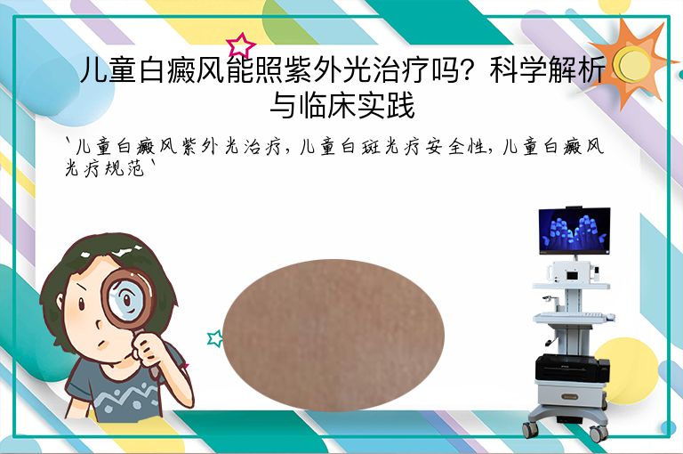 儿童白癜风能照紫外光治疗吗？科学解析与临床实践”