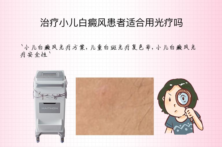 治疗小儿白癜风患者适合用光疗吗