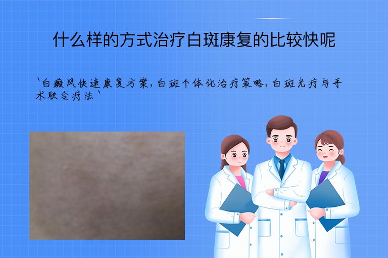 什么样的方式治疗白斑康复的比较快呢