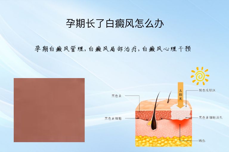 https://www.bdfsjzyy.com/d/file/p/907c06acbae0aaecbccd73d2889c08f0.jpeg