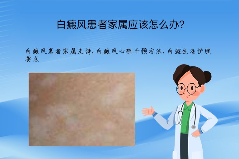 白癜风患者家属应该怎么办？”