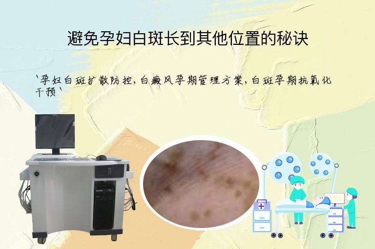 避免孕妇白斑长到其他位置的秘诀