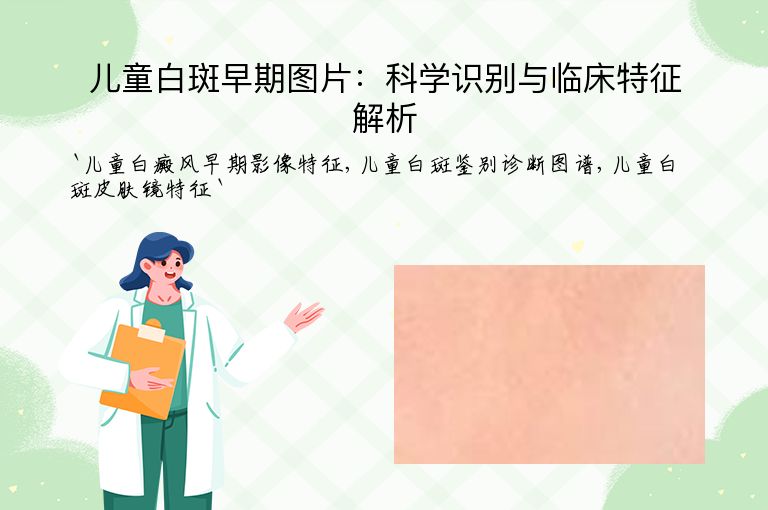 儿童白斑早期图片:科学识别与临床特征解析