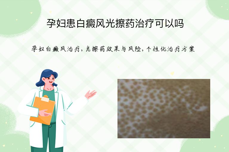 孕妇患白癜风光擦药治疗可以吗”