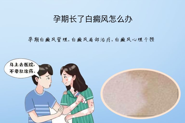 孕期长了白癜风怎么办”