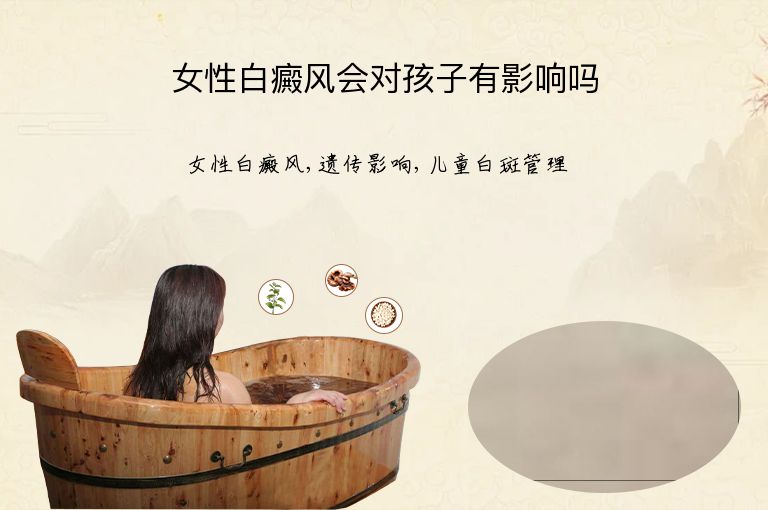 女性白癜风会对孩子有影响吗”