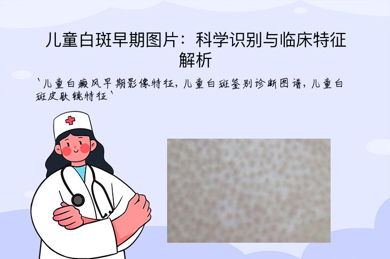 儿童白斑早期图片:科学识别与临床特征解析