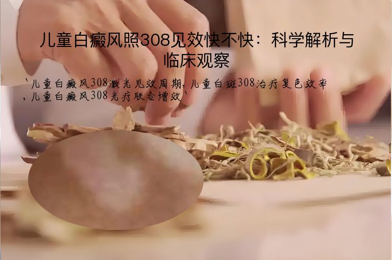 儿童白癜风照308见效快不快：科学解析与临床观察