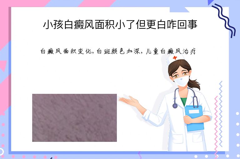 小孩白癜风面积小了但更白咋回事”