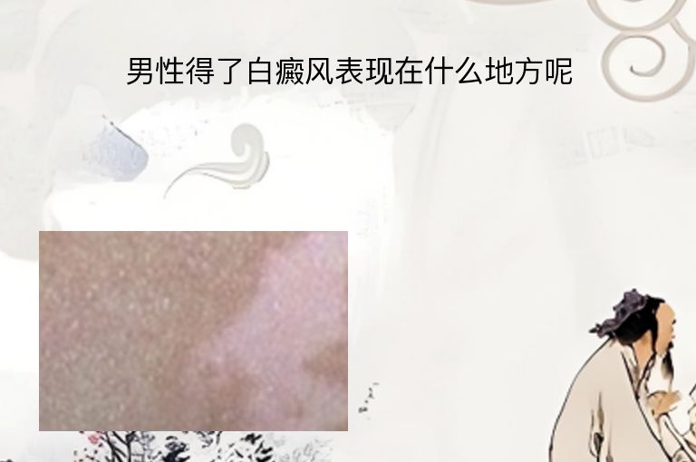 https://www.bdfsjzyy.com/d/file/p/fd32a9f030632cff0bf4636f774f77e5.jpeg