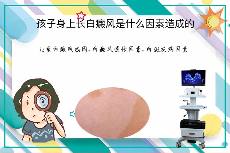 孩子身上长白癜风是什么因素造成的”