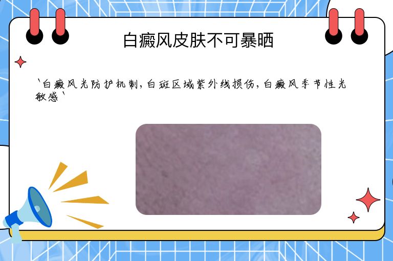 白癜风皮肤不可暴晒”