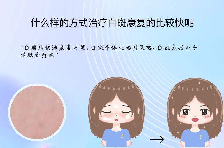 什么样的方式治疗白斑康复的比较快呢
