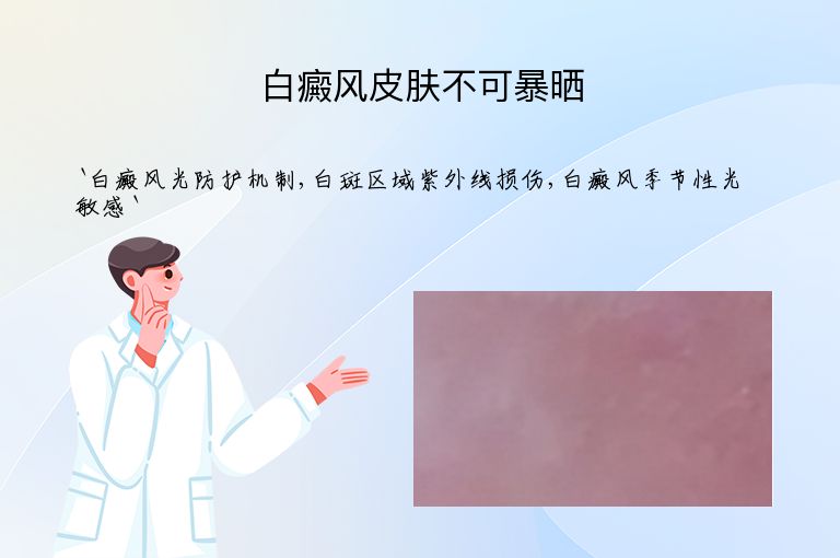 白癜风皮肤不可暴晒