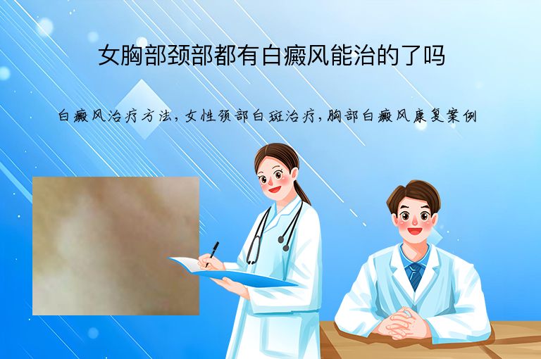 https://www.bdfsjzyy.com/d/file/p/ba8f2915abeb6027c1fff614d7db55ee.jpeg