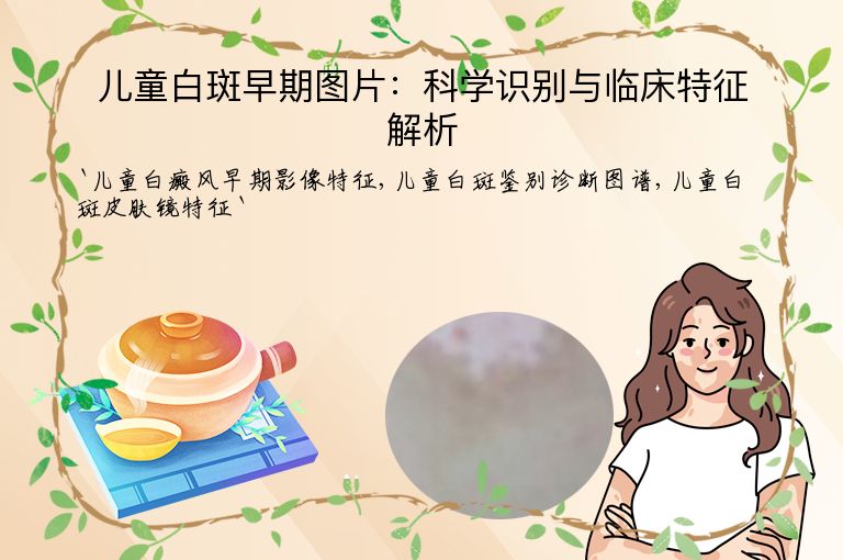 儿童白斑早期图片:科学识别与临床特征解析