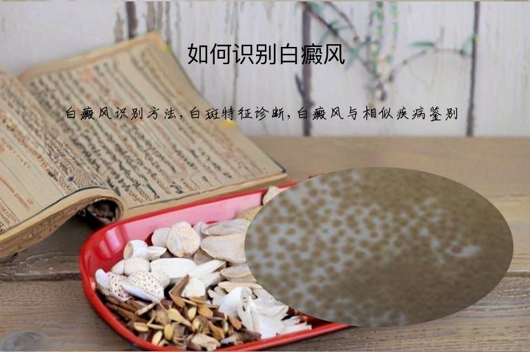 https://www.bdfsjzyy.com/d/file/p/8ed1022c0a4c10cb8976e7d4e6b53c0a.jpeg