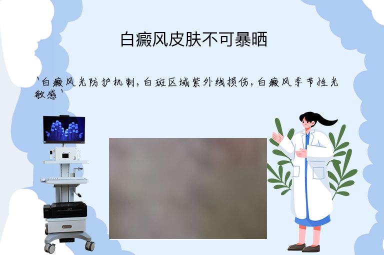 白癜风皮肤不可暴晒