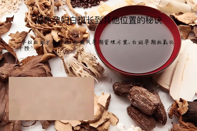 避免孕妇白斑长到其他位置的秘诀
