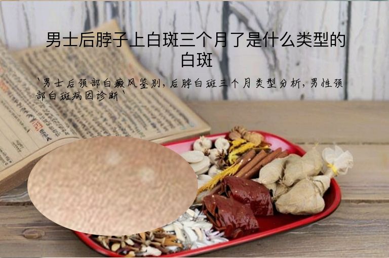 男士后脖子上白斑三个月了是什么类型的白斑”