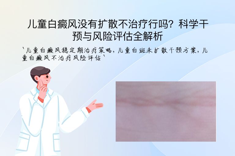 儿童白癜风没有扩散不治疗行吗？科学干预与风险评估全解析