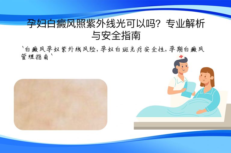 孕妇白癜风照紫外线光可以吗？专业解析与安全指南”