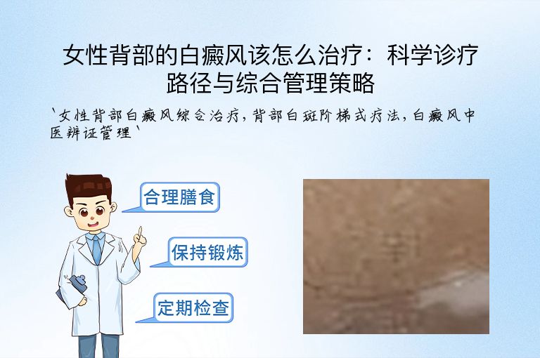 女性背部的白癜风该怎么治疗:科学诊疗路径与综合管理策略