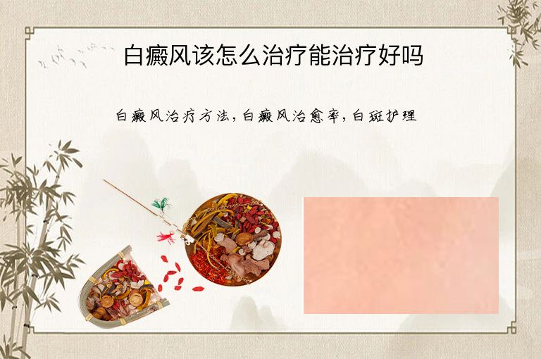 白癜风该怎么治疗能治疗好吗”