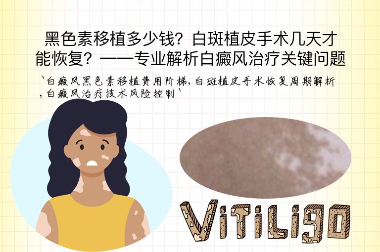 https://www.bdfsjzyy.com/d/file/p/cf15b9f81492ce9c6cfb1521349780f3.jpeg