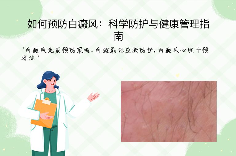 如何预防白癜风：科学防护与健康管理指南