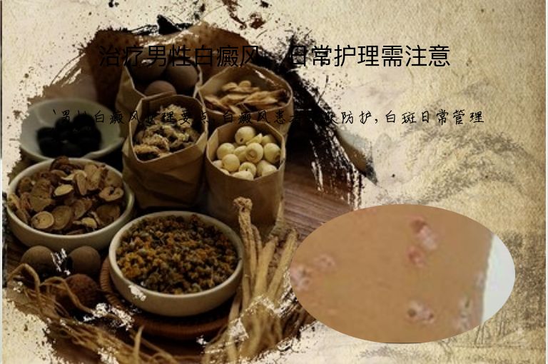 治疗男性白癜风,日常护理需注意