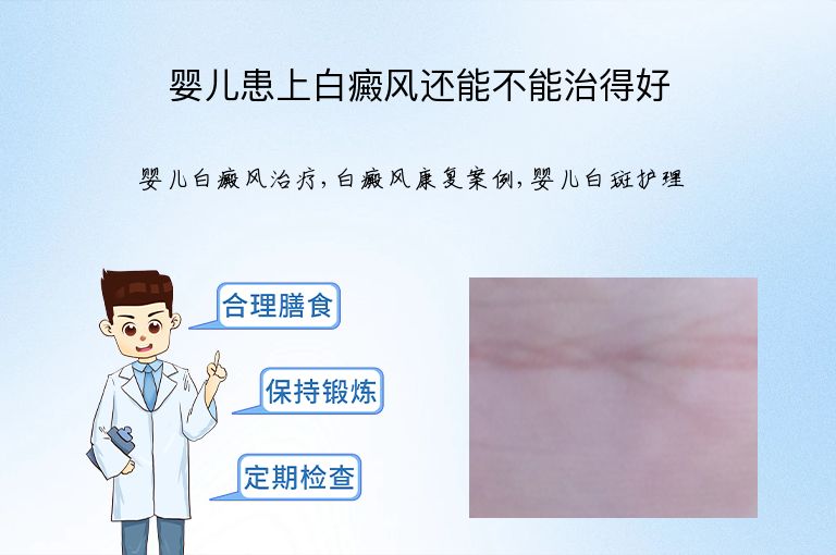 https://www.bdfsjzyy.com/d/file/p/07f7b9e5d6e72bfdbe53554e1e214446.jpeg